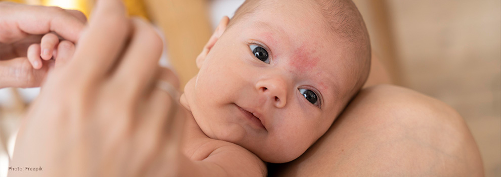 Baby liegt auf den Knien der Mutter, sie hält behutsam die kleinen Händchen